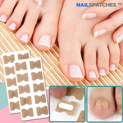 👣CORRECTORES DE UÑAS ENCARNADAS - NAILSPATCHES™